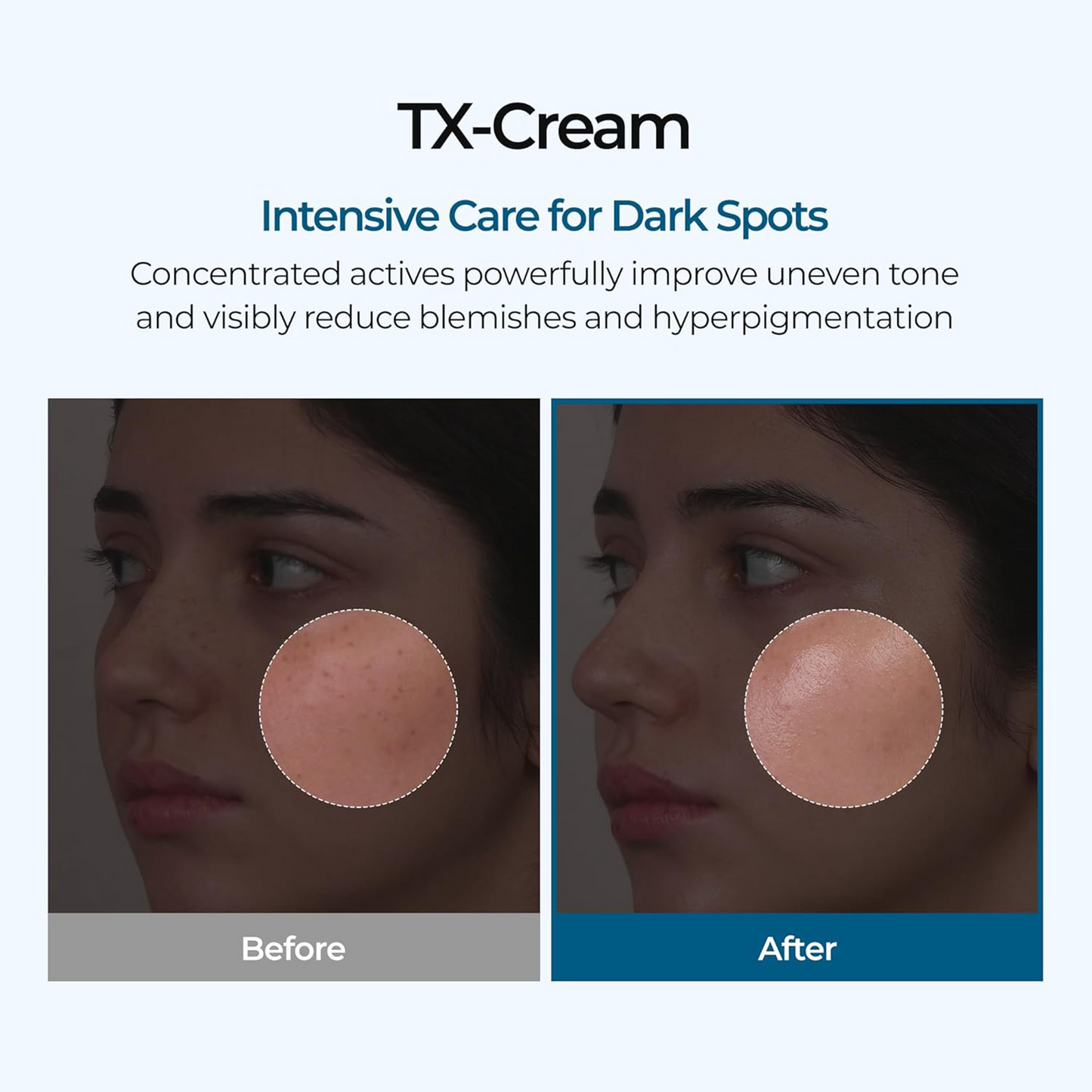 LOVILDS™ TX Cream 50ml —Target Dark Spots, Even Skin Tone & Reveal Radiant Skin