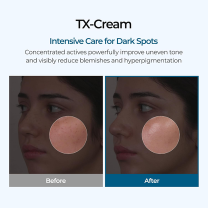 LOVILDS™ TX Cream 50ml —Target Dark Spots, Even Skin Tone & Reveal Radiant Skin